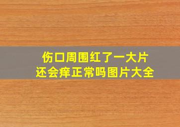 伤口周围红了一大片还会痒正常吗图片大全