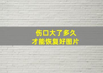 伤口大了多久才能恢复好图片