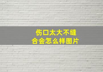 伤口太大不缝合会怎么样图片