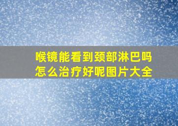 喉镜能看到颈部淋巴吗怎么治疗好呢图片大全