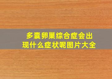 多囊卵巢综合症会出现什么症状呢图片大全