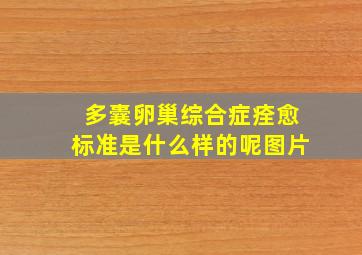 多囊卵巢综合症痊愈标准是什么样的呢图片