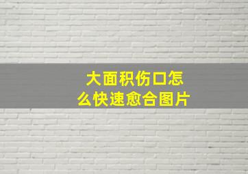 大面积伤口怎么快速愈合图片