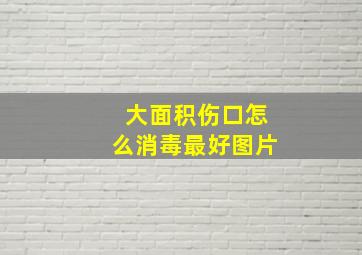 大面积伤口怎么消毒最好图片