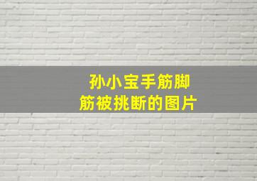 孙小宝手筋脚筋被挑断的图片