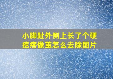 小脚趾外侧上长了个硬疙瘩像茧怎么去除图片