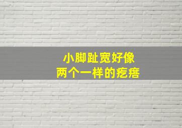 小脚趾宽好像两个一样的疙瘩