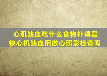 心肌缺血吃什么食物补得最快心机缺血用做心照影检查吗