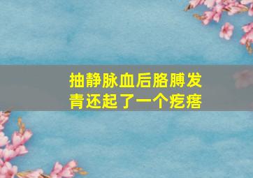 抽静脉血后胳膊发青还起了一个疙瘩