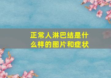 正常人淋巴结是什么样的图片和症状