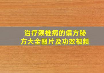 治疗颈椎病的偏方秘方大全图片及功效视频