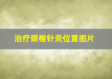 治疗颈椎针灸位置图片