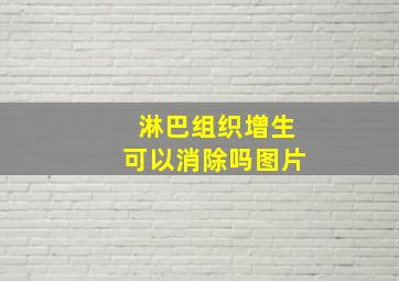 淋巴组织增生可以消除吗图片