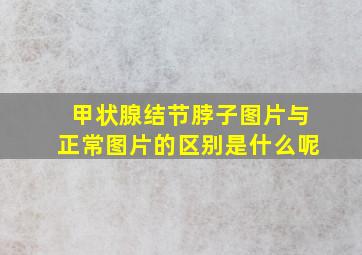 甲状腺结节脖子图片与正常图片的区别是什么呢