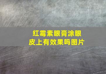 红霉素眼膏涂眼皮上有效果吗图片