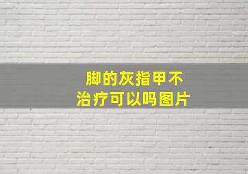 脚的灰指甲不治疗可以吗图片