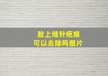 脸上缝针疤痕可以去除吗图片