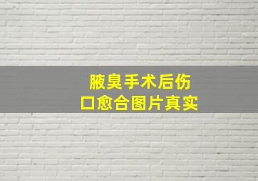 腋臭手术后伤口愈合图片真实