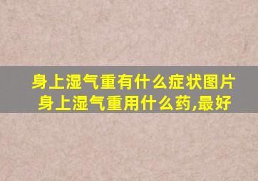 身上湿气重有什么症状图片身上湿气重用什么药,最好