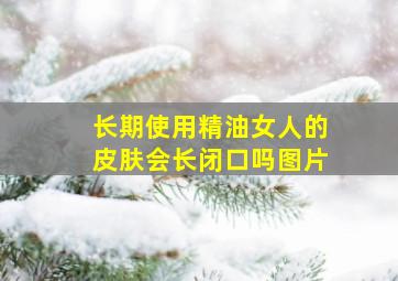 长期使用精油女人的皮肤会长闭口吗图片