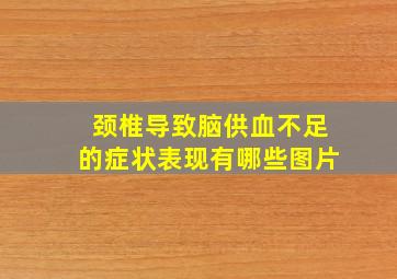 颈椎导致脑供血不足的症状表现有哪些图片