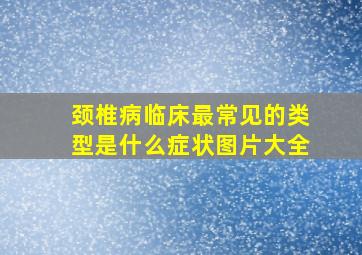 颈椎病临床最常见的类型是什么症状图片大全