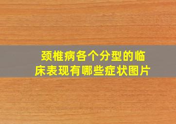 颈椎病各个分型的临床表现有哪些症状图片