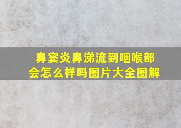 鼻窦炎鼻涕流到咽喉部会怎么样吗图片大全图解